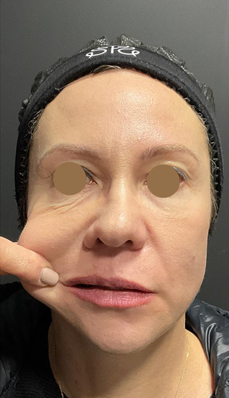 Morpheus-1-1 Morpheus-1-1