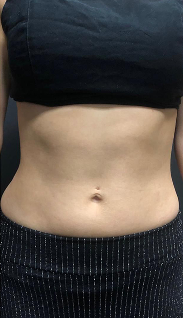 Morpheus-2-1 Morpheus-2-1